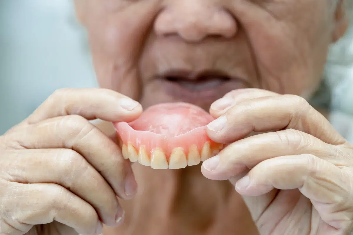 You are currently viewing Dentures